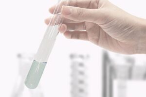 五月病やダイエットにも！ 話題の【遺伝子解析】で、今こそ "自分に最適化" した健康管理を｜GLADDブログ
